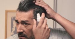 Man says £1 a day hair loss treatment saw barber accuse him of 'having a hair transplant'