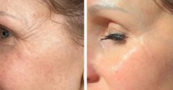 This LED mask with £219 off has women ditching makeup for ‘healthier, youthful' skin