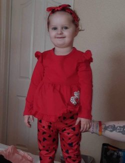 Girl, 3, dies from 'most horrific' lice infestation and child neglect