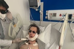 Man has his jaw rebuilt with leg bone after horror fall chasing thief