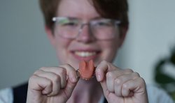 Cancer survivor given artificial tongue in 'NHS first'