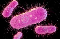 Horror as 27 people sick after outbreak of deadly bacteria - 5 in hospital