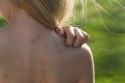 Brits issued horror bedbug alert as infestations break out in three key locations