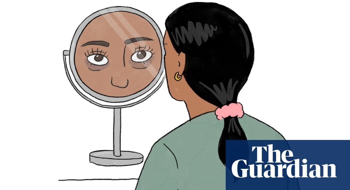 Beauty dilemmas: Iâm south Asian and have dark eye circles. What can I do? | Beauty