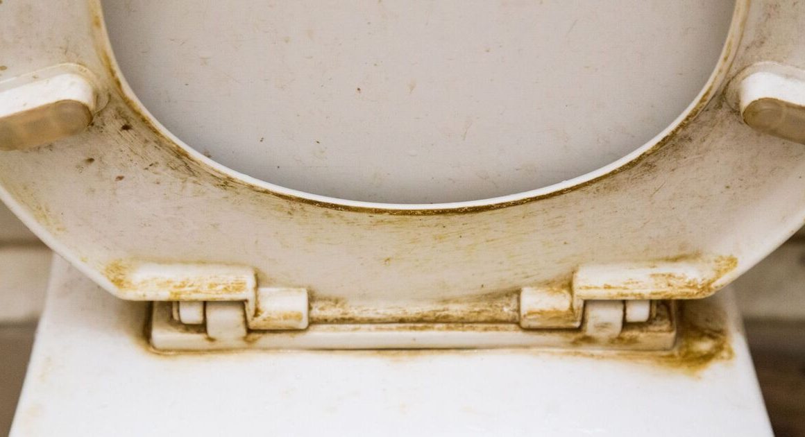 How to remove stains from toilet seat without bleach – no chemicals at all
