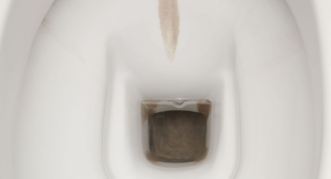 How to remove limescale from toilet for good without bleach or scrubbing