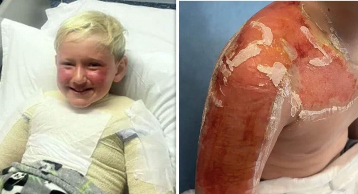 Mum’s warning over ‘expired’ factor 90 suncream as son suffers blisters | UK | News