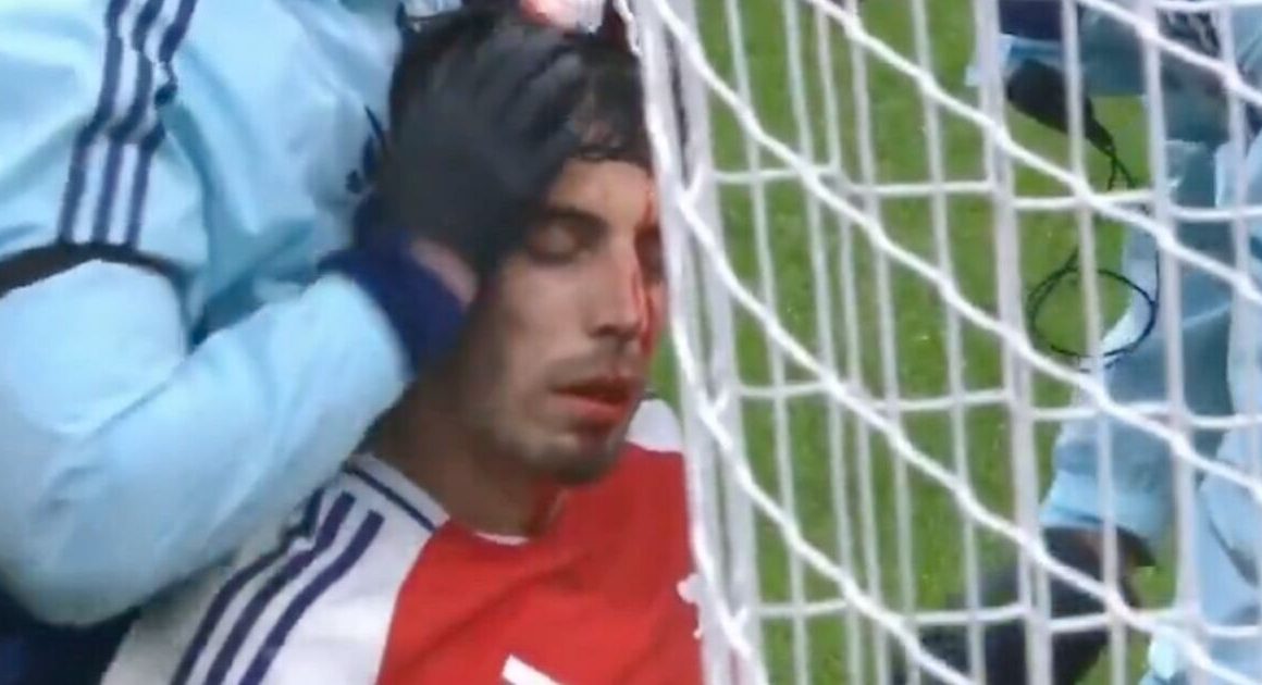 Kai Havertz suffers horror injury as Arsenal forward and physio drenched in blood | Football | Sport