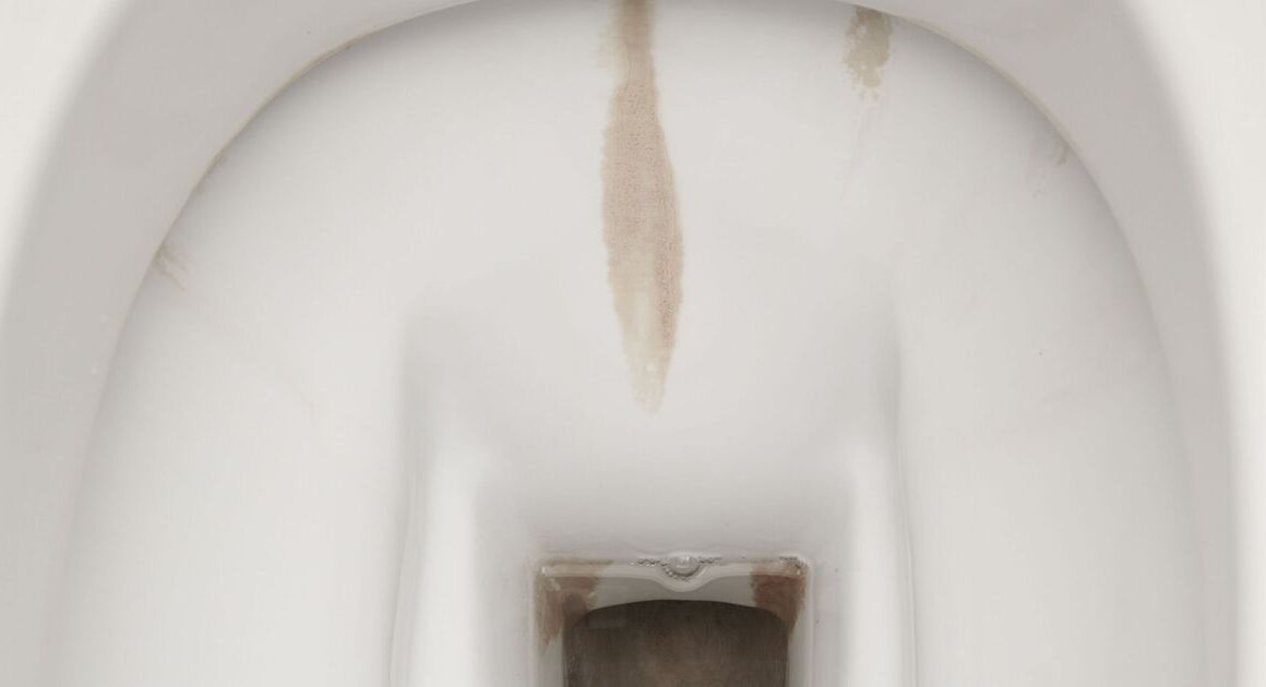 Cleaning pro swears by 49p item to dissolve toilet stains without chemicals – not vinegar