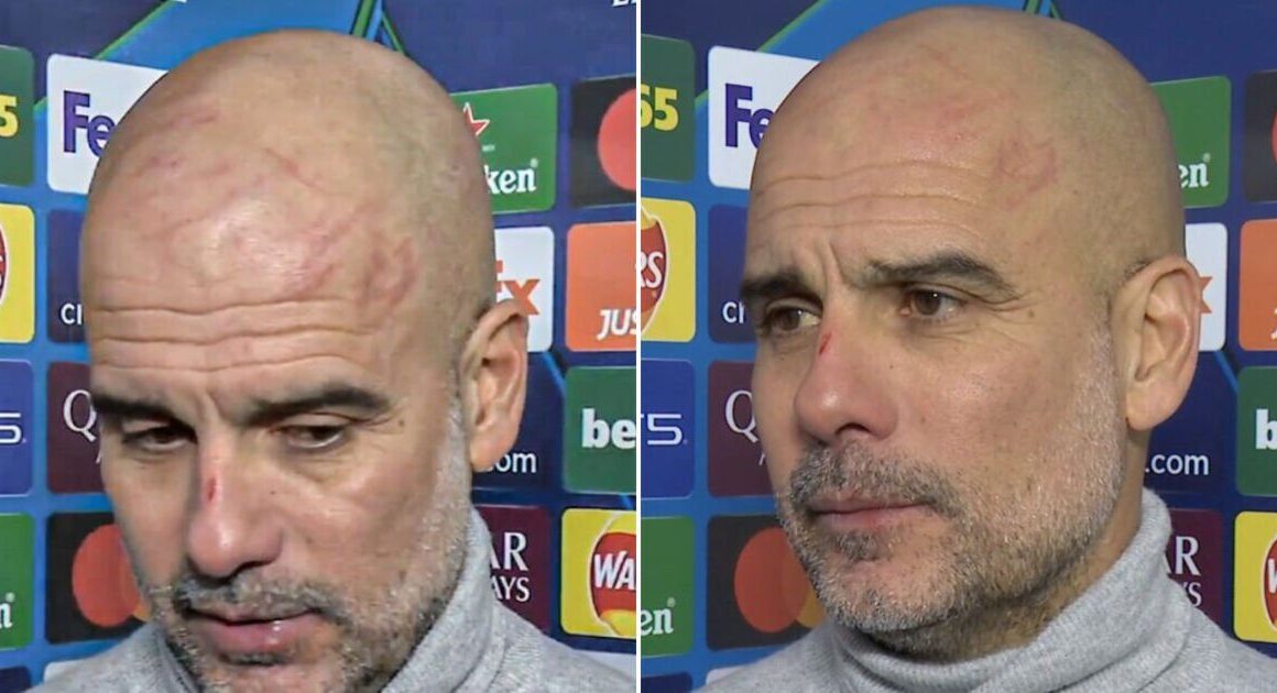 Pep Guardiola gives worrying explanation for cuts on his face after Man City draw | Football | Sport