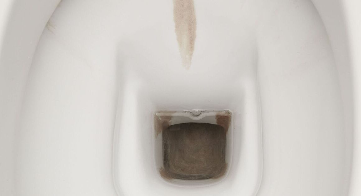 How to remove limescale from toilets fast without bleach